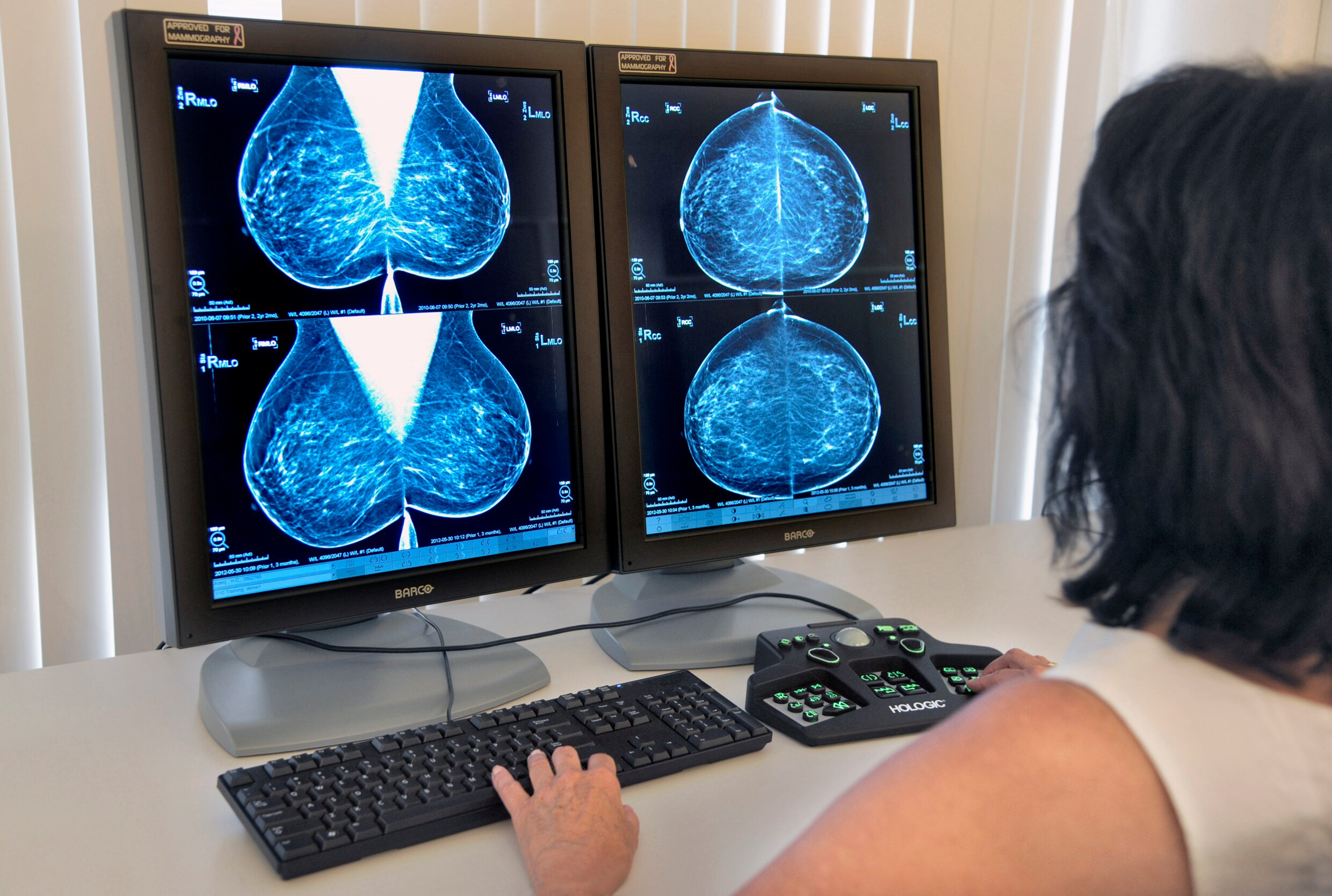 Een arts bekijkt de beelden van een mammografie, gemaakt tijdens het bevolkingsonderzoek borstkanker.