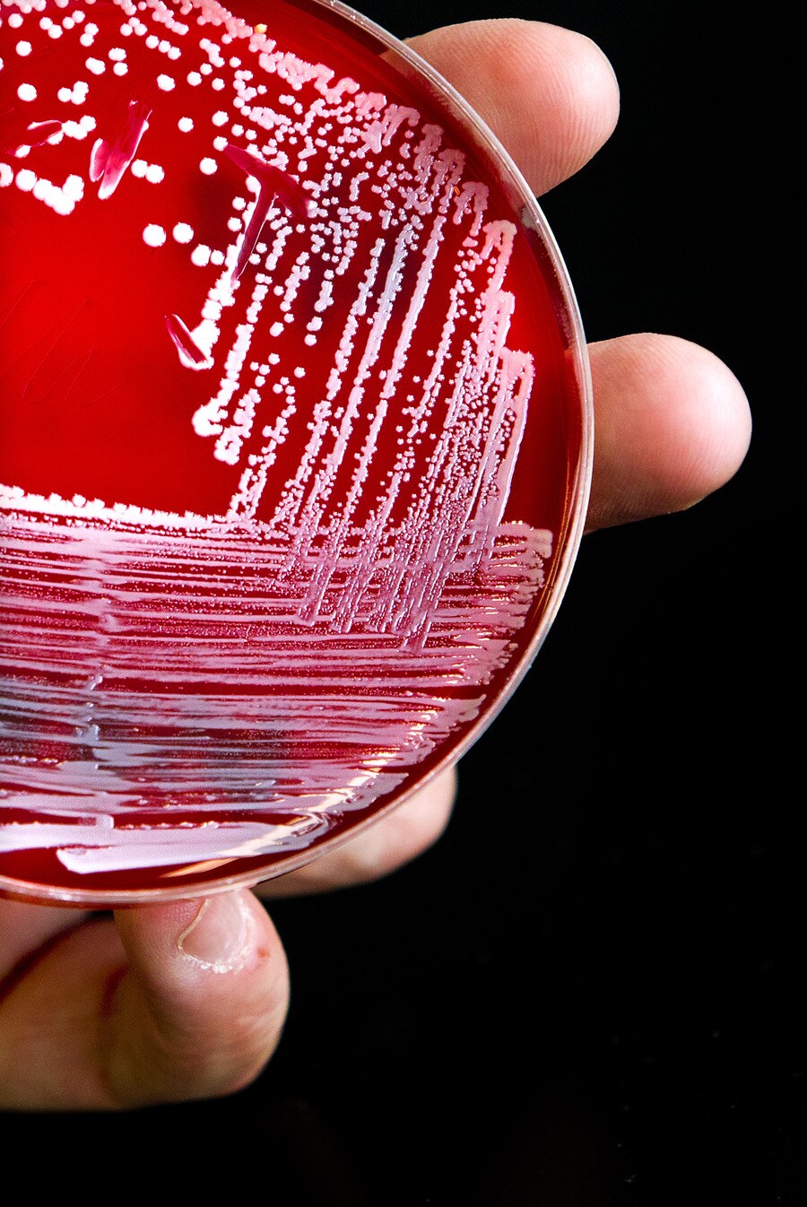 Mens draagt 1 kilo aan bacteriën met zich mee | Trouw